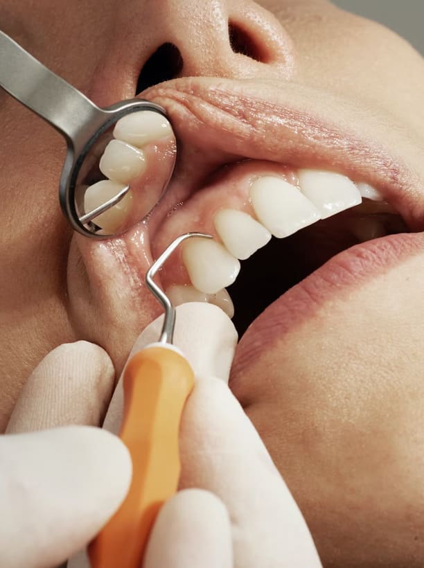 Dental Examination Kirkland